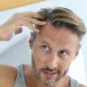 How to Stop Losing Hair: The Lordhair Guide for Men