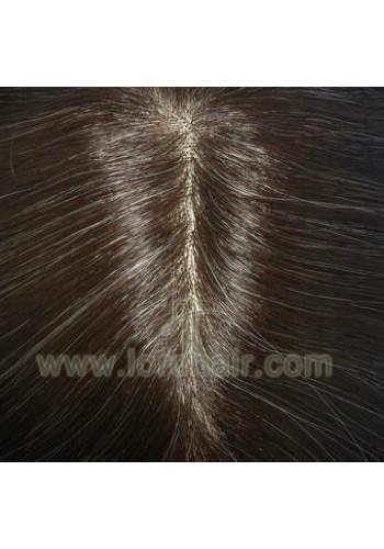 jq1057 hair replacement system