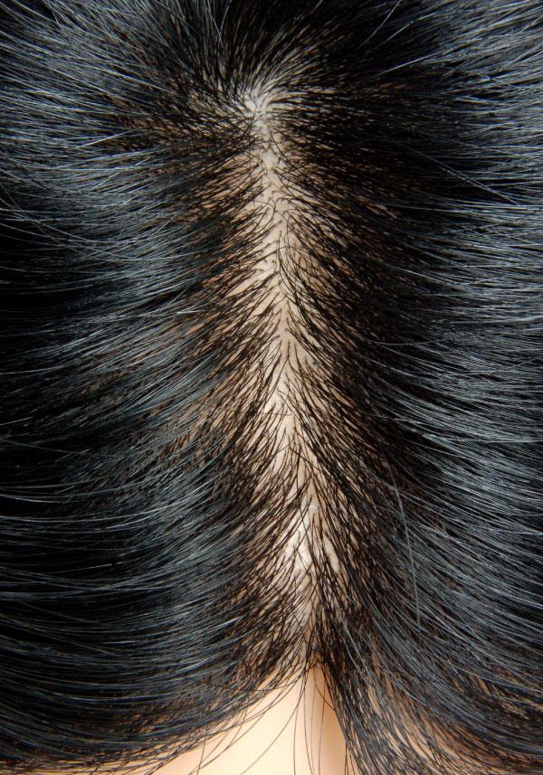 s24-super-thin-skin-lift-inject-toupee-wig-2