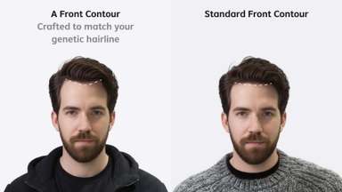 Hybrid Hair System - Multi-functional Design - Enhanced Airflow - Low Maintenance - (Recommended)		-image-7
