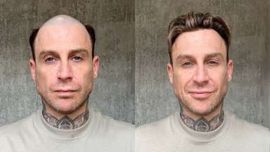 Hybrid Hair System - Multi-functional Design - Enhanced Airflow - Low Maintenance - (Recommended)		-image-1