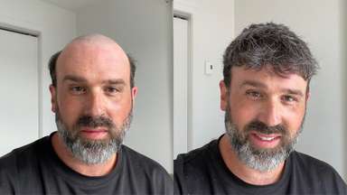 80% Low-Density Men's Hairpiece with Super Fine Welded Mono Base - Natural Hairline-image-7