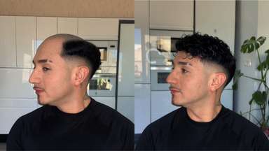 Royal-C | Men’s Clip-On Hairpieces for Thinning Hair designed with Fine Mono and PU Perimeter-image-3