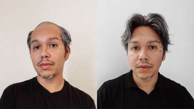 SuperSkin | 0.08mm Super Thin Skin Stock Men's Hair Systems - Effortless, Easy to Wear-image-8