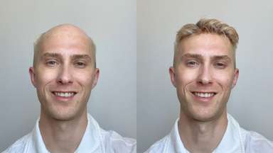 UTS | 0.03mm Ultra Thin Skin V-looped Stock Men's Hairpieces - Celebs' Top Choice-image-10