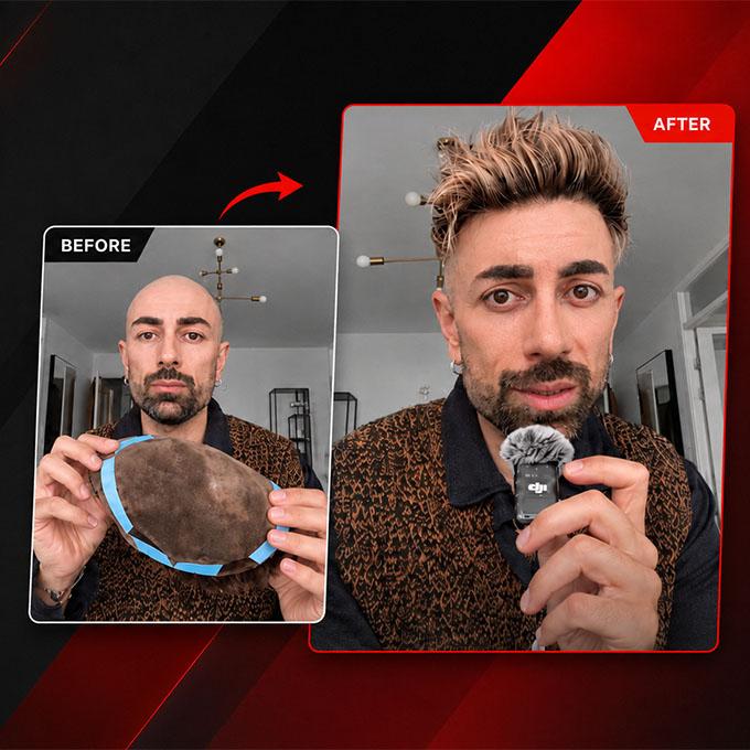 How to Use Hair System Tape the Right Way