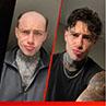 Are Toupees a Good Solution for Hair Loss? 
