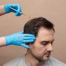 Hair Plugs vs. Hair Transplant: Everything You Need to Know 