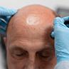 The Rise of Bioengineered Hair Systems: Could Lab-Grown Hair Be the Future?