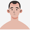 The Best Hair Systems for Specific Hair Loss Patterns