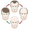 2025’s Most Realistic Hair Systems: What Sets Them Apart?