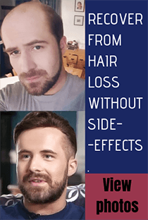 Hair Toupees