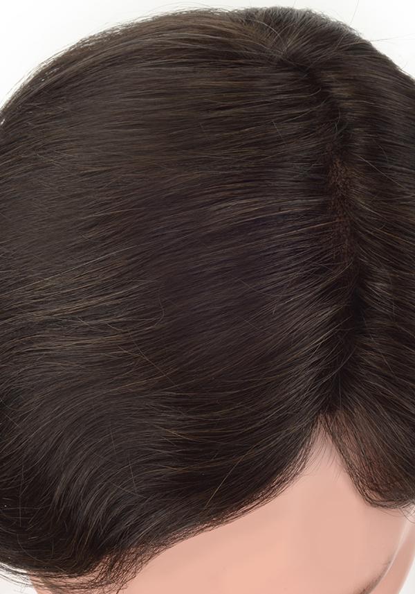 l7 hair replacement system