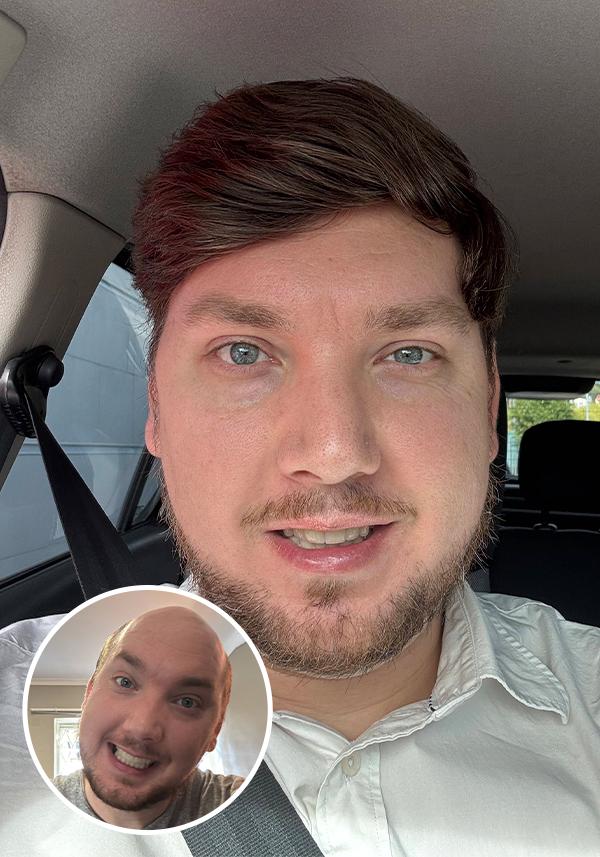 French Lace Top with 2 inches Skin Perimeter Hairpiece