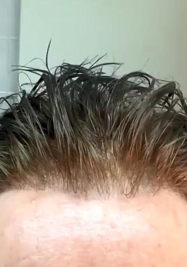 UTS-F | Ultra Thin Skin Men’s Freely Customizable Hair Frontals