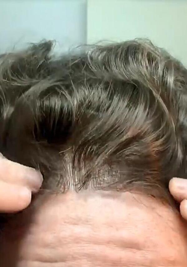 UTS-F | Ultra Thin Skin Men’s Freely Customizable Hair Frontals