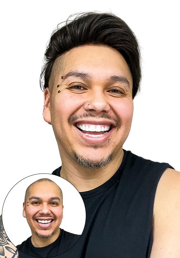 SuperSkin-V before vs after