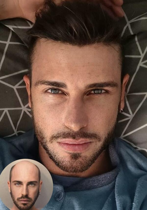 Super Thin Skin Men's Hair Systems with Lace Front V-looped