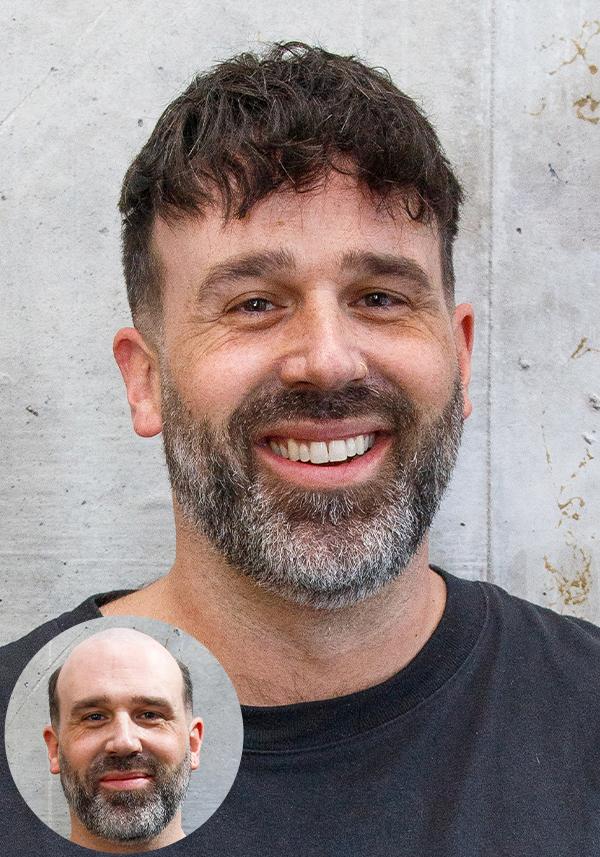 SuperSkin-V before vs after