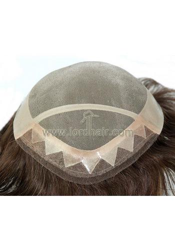 jq569 hair replacement system