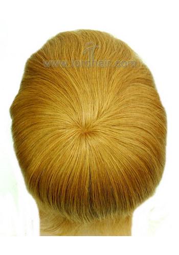 jq1180 hair replacement system