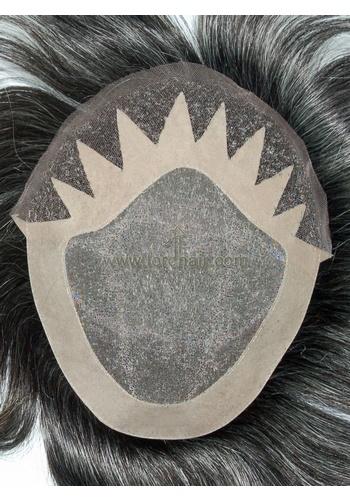 jq556 hair replacement system