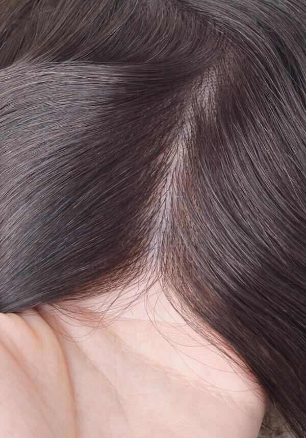 Injected Thin Skin Men’s Hair System