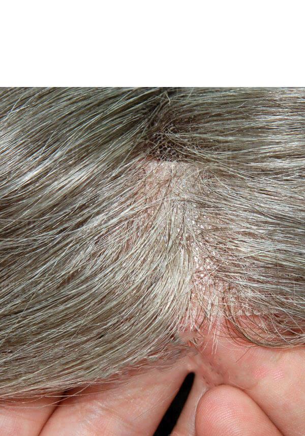 Invisible hair system