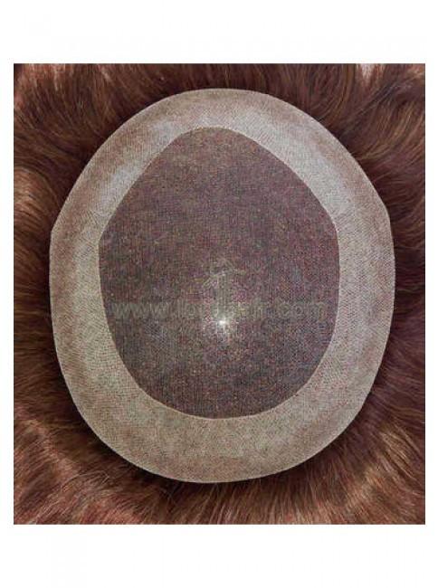 jq1050 hair replacement system