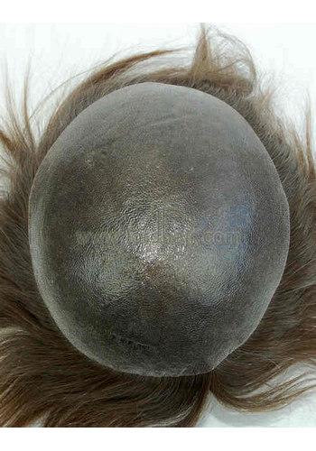 jq1158 hair replacement system
