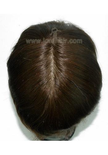 jq1175 hair replacement system