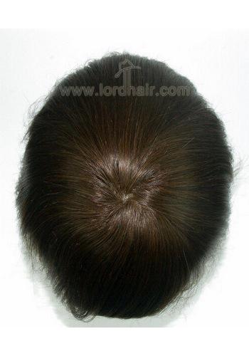 jq1194 hair replacement system