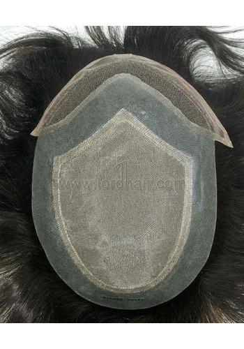 jq1198 hair replacement system