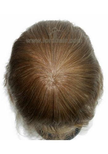 jq1217 hair replacement system