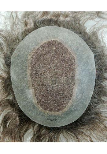 jq1221 hair replacement system