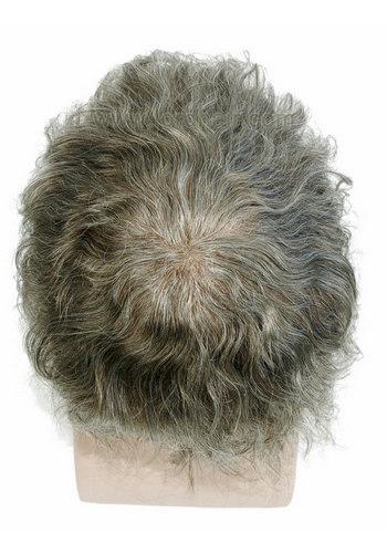 jq1221 hair replacement system