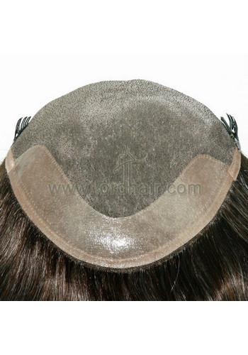 jq1280 hair replacement system