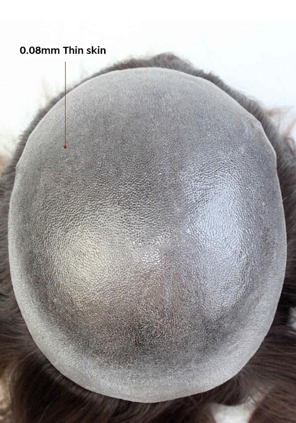 Injected hairpiece
