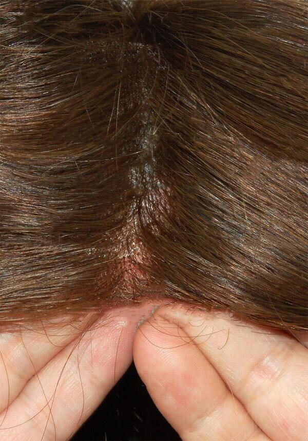 Invisible hair system