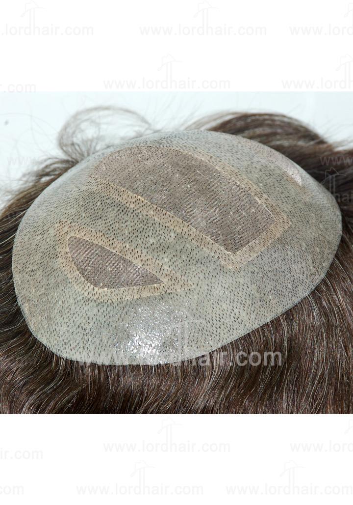 jq543 hair replacement system