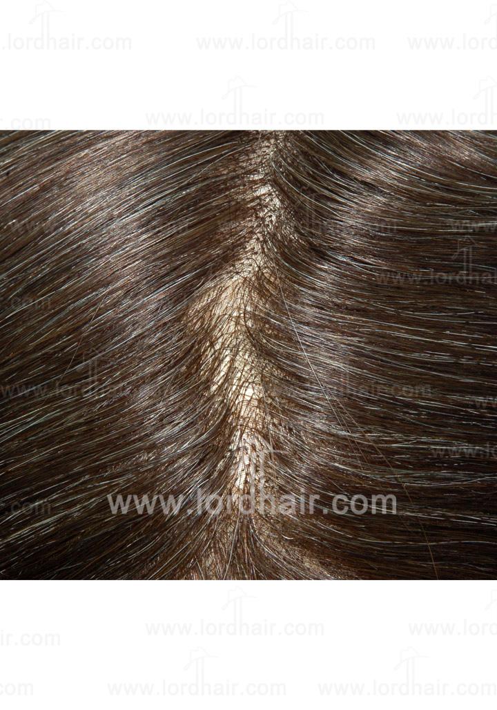 jq543 hair replacement system