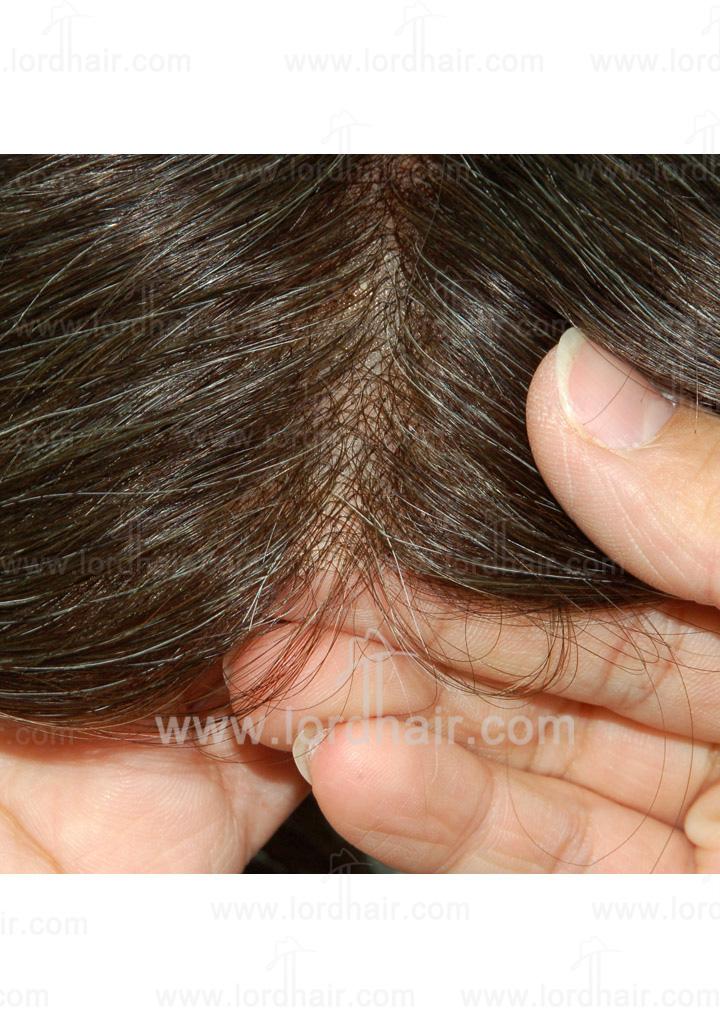 jq543 hair replacement system