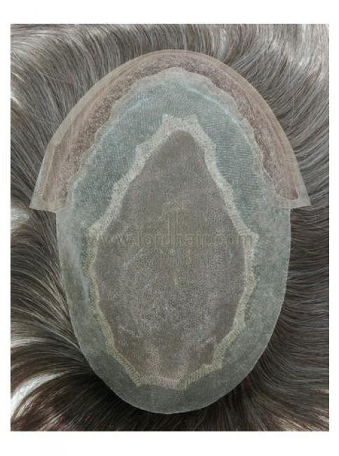 jq931 hair replacement system