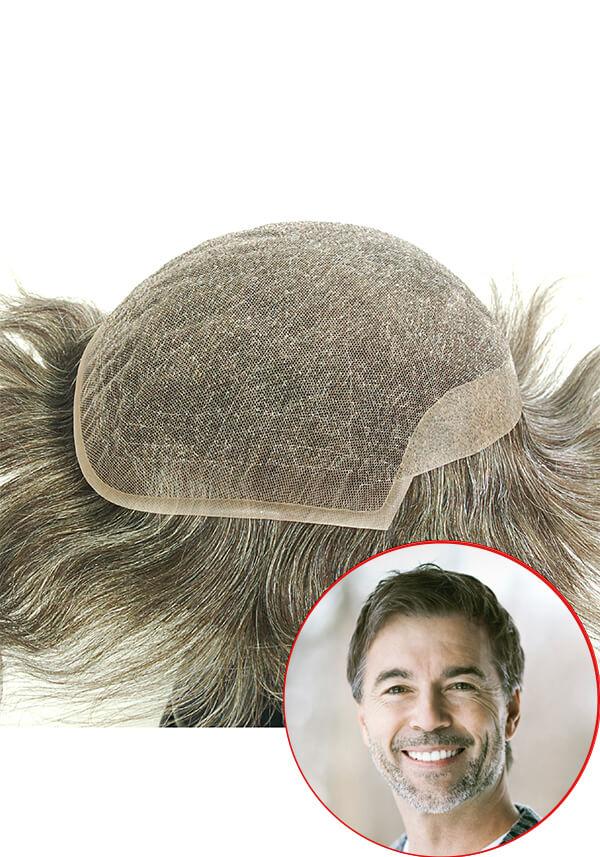l15 hair replacement system