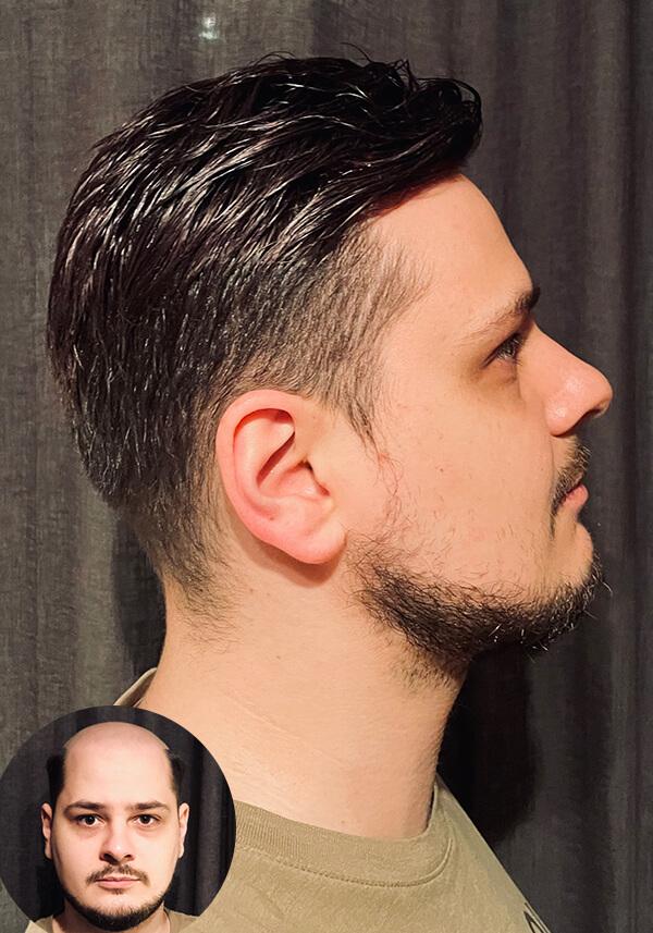  Stock French Lace Hair Piece for Men