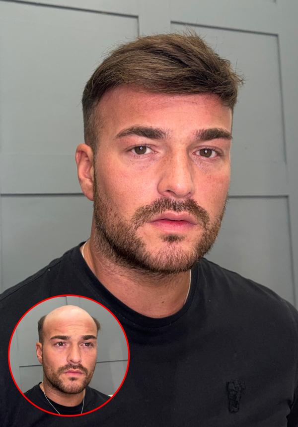 Full French Lace Hair System