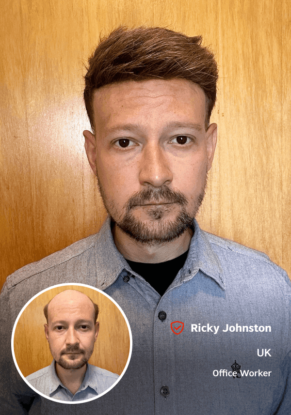 Super Thin Skin Hair Piece