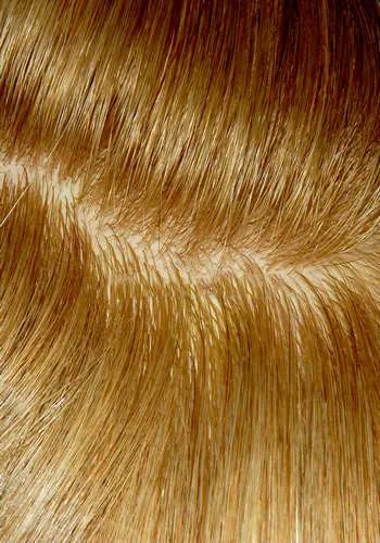 Silicon Skin Hair Replacement
