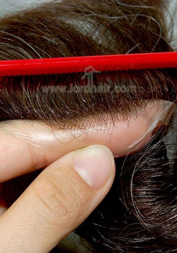 s22 hair replacement system