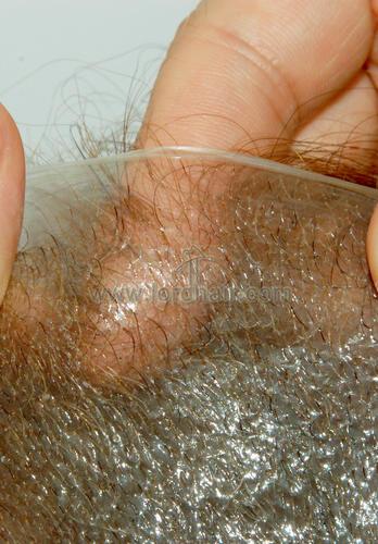 s22 hair replacement system